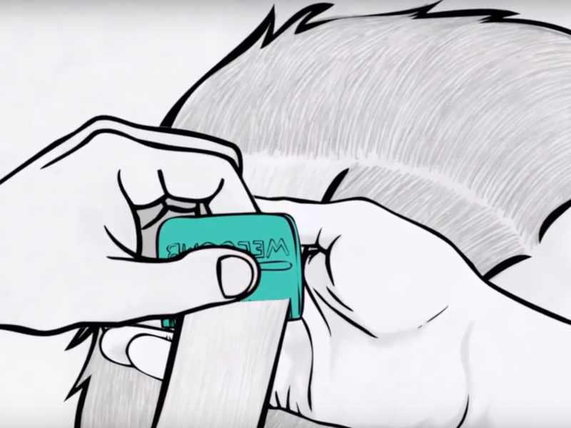 VIDEO: Cómo remover a los piojos y las liendres con WelComb®