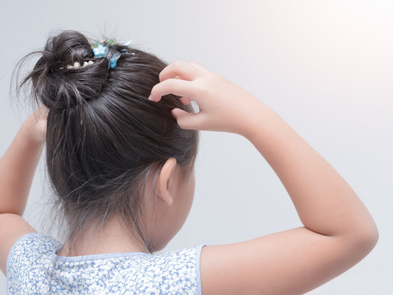 Investigación nueva muestra vínculo entre los tratamientos contra piojos y los comportamientos anormales en los niños